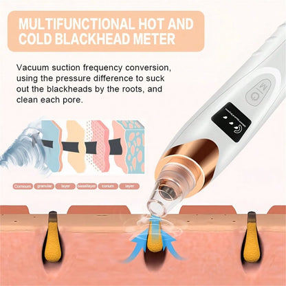 Electric Blackhead Remover Pore Vacuum