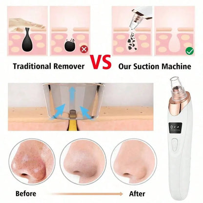 Electric Blackhead Remover Pore Vacuum